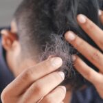 Reportage: Pfusch und Betrug – das Geschäft mit schönen Haaren